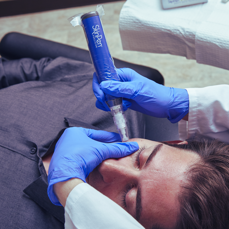 microneedling treatment for mens fine lines and wrinkles